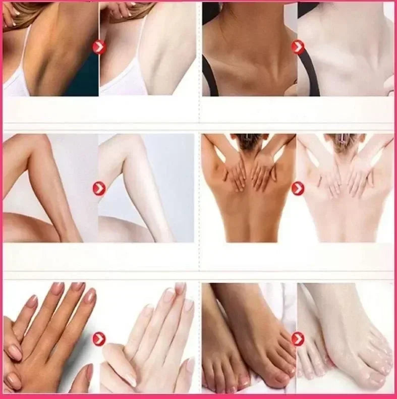 Skin Whitening Cream for Dark Skin Lightening Private Parts Whitening Cream  Arm Thigh Body Knees Whitening Brighten Skin Mild