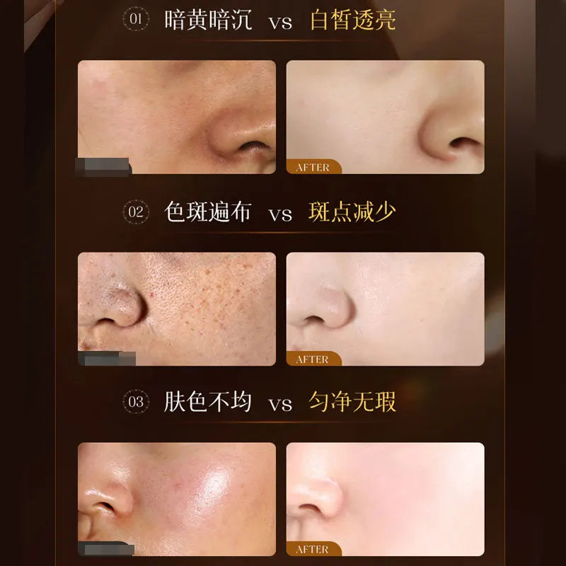 Genuine Men's Whitening and Anti-freckle Cream, Lightening Spots and Brightening Skin Tone, Men's Skin Care Products