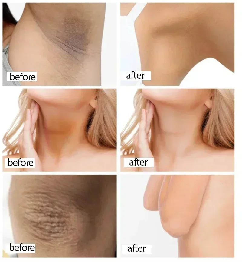 Skin Whitening Cream for Dark Skin Lightening Private Parts Whitening Cream  Arm Thigh Body Knees Whitening Brighten Skin Mild