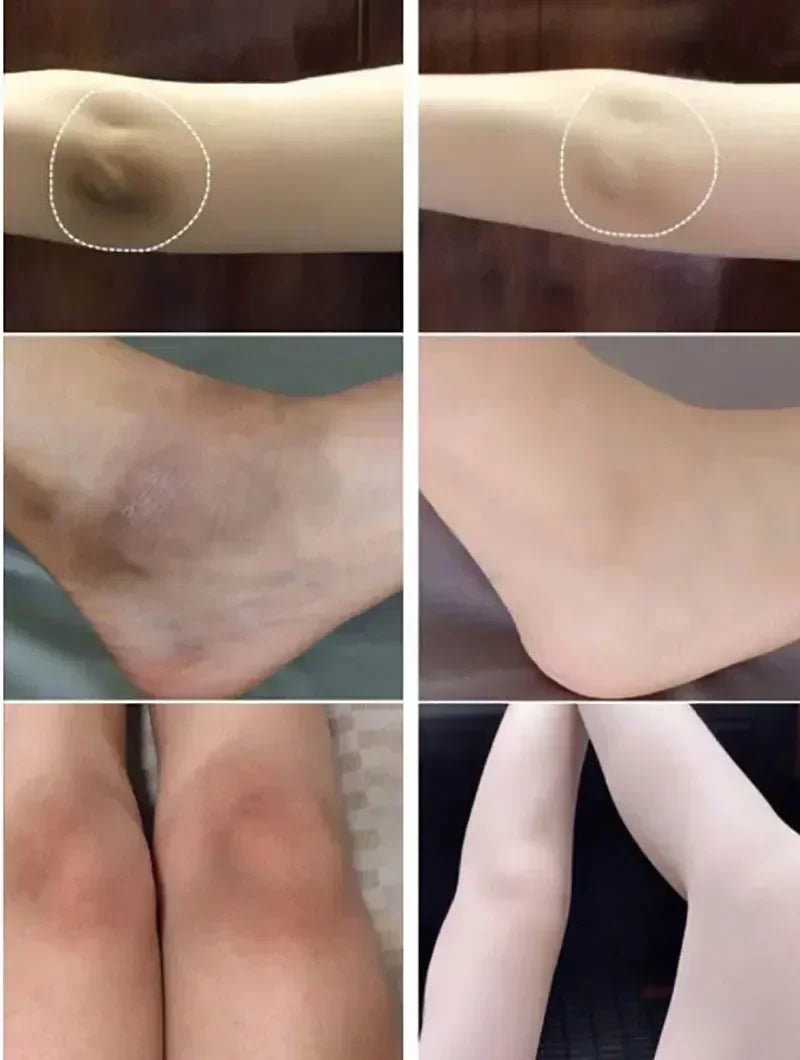 Skin Whitening Cream for Dark Skin Lightening Private Parts Whitening Cream  Arm Thigh Body Knees Whitening Brighten Skin Mild