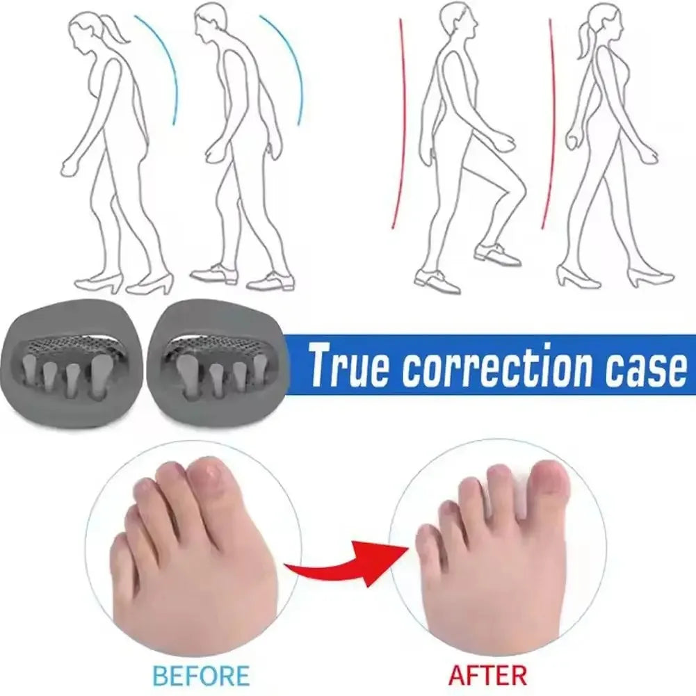 Women's Arch Support Massage Slippers Thick Soled Slide Sandals Shaking Slimming Shoes Postpartum Leg Massage Foot Relief