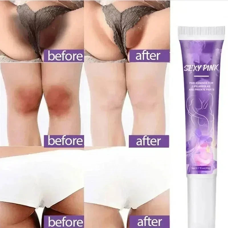 Skin Whitening Cream for Dark Skin Lightening Private Parts Whitening Cream  Arm Thigh Body Knees Whitening Brighten Skin Mild