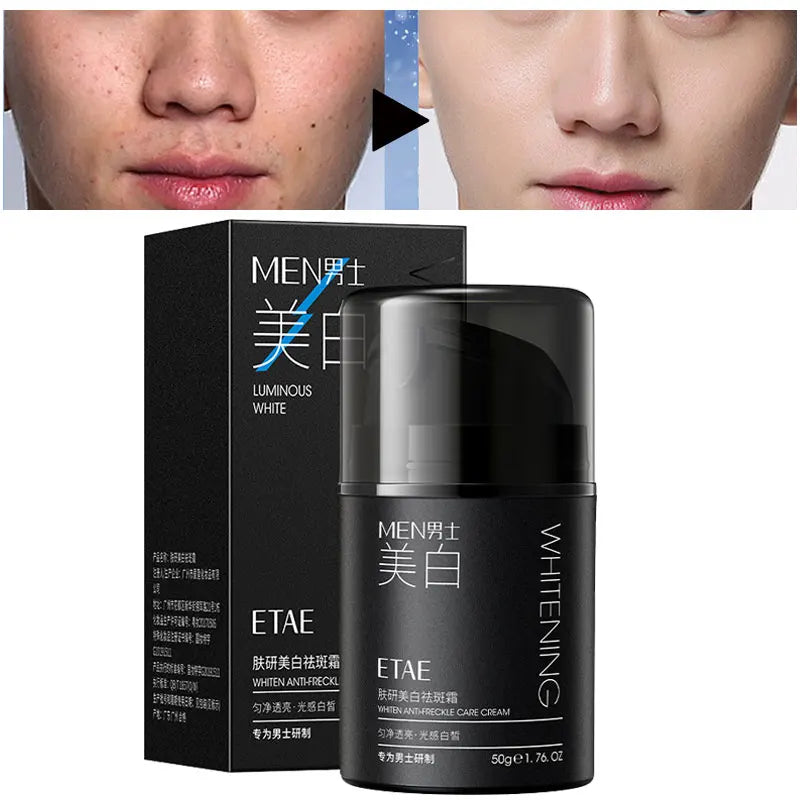 Genuine Men's Whitening and Anti-freckle Cream, Lightening Spots and Brightening Skin Tone, Men's Skin Care Products